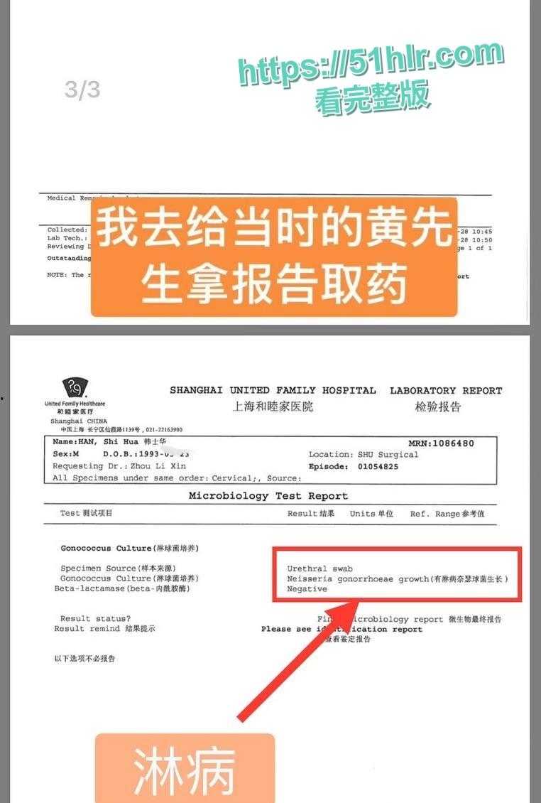 顶级明星【黄景瑜】的性病丑闻炸毁娱乐圈!与女星【张艺上】做爱视频流出,前妻【王雨馨】8年网络敲击彻底撕开渣男真面目-8