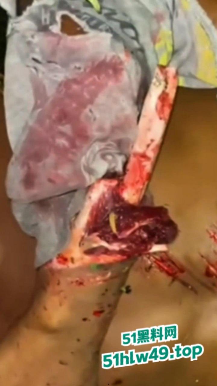 血腥恐怖，非洲南部车祸乡间公路步行，司机未看清路况当场将撞飞路人，手脚全断死相极其残忍。-5