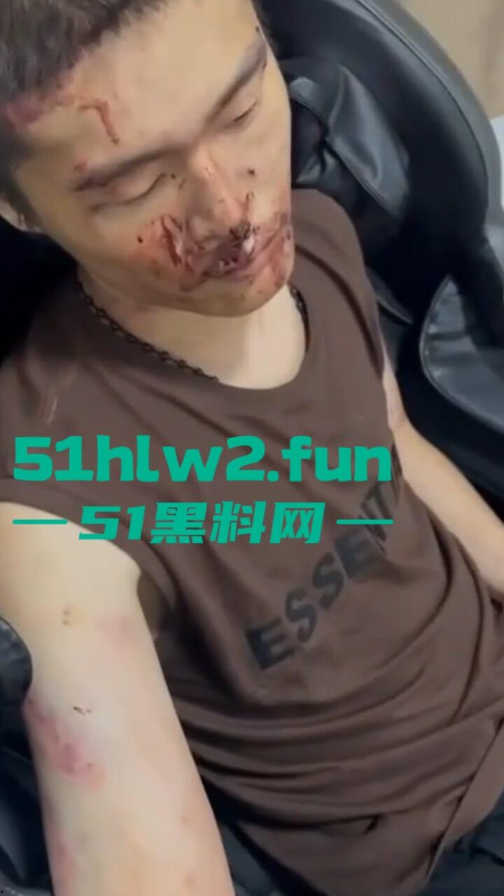 园区猪仔真实近况,绑架后只有受虐的份,电击殴打口吐鲜血境外没有高薪工作,只有无尽的折磨。-5