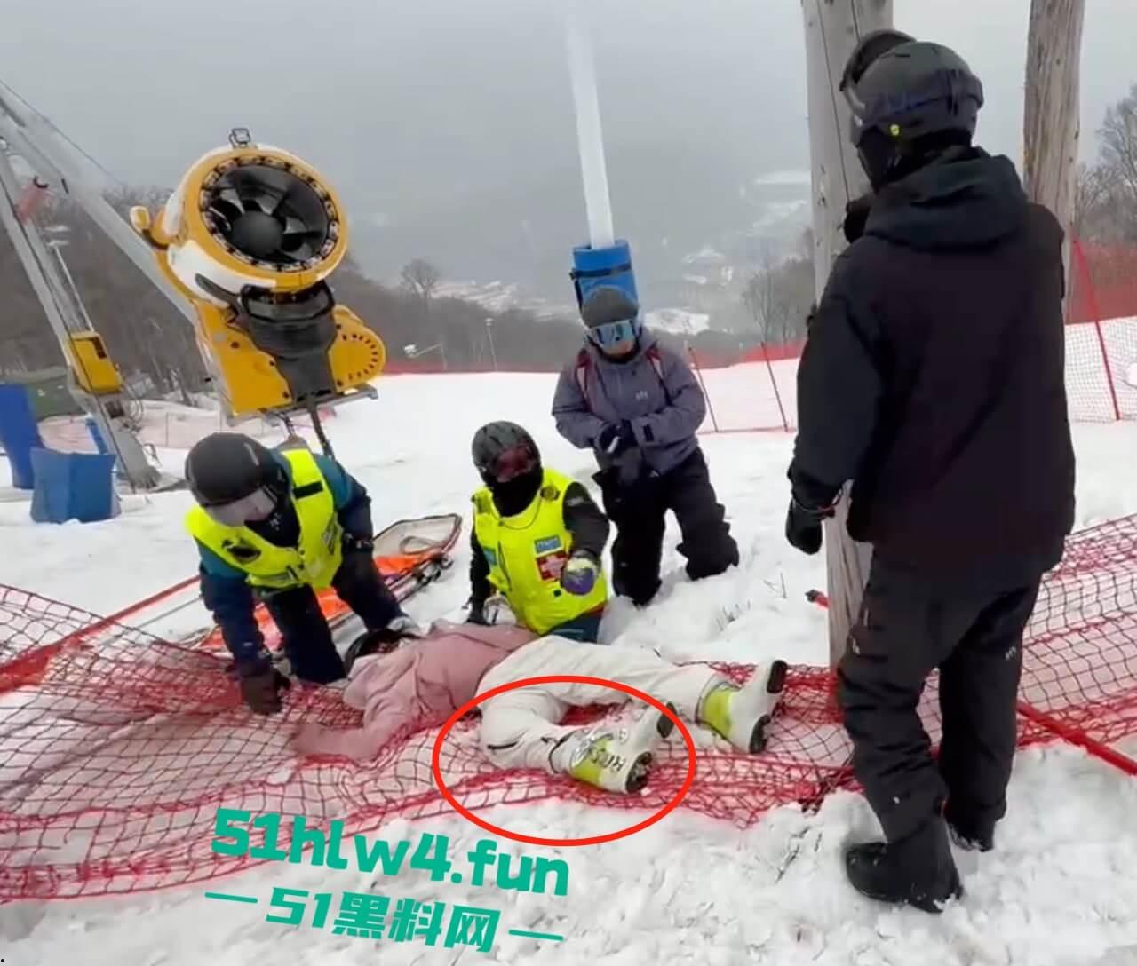 北大湖滑雪场新手滑雪妹,误入中高级滑道滑雪,不慎摔飞被撞到变形断腿场面超吓人。-2