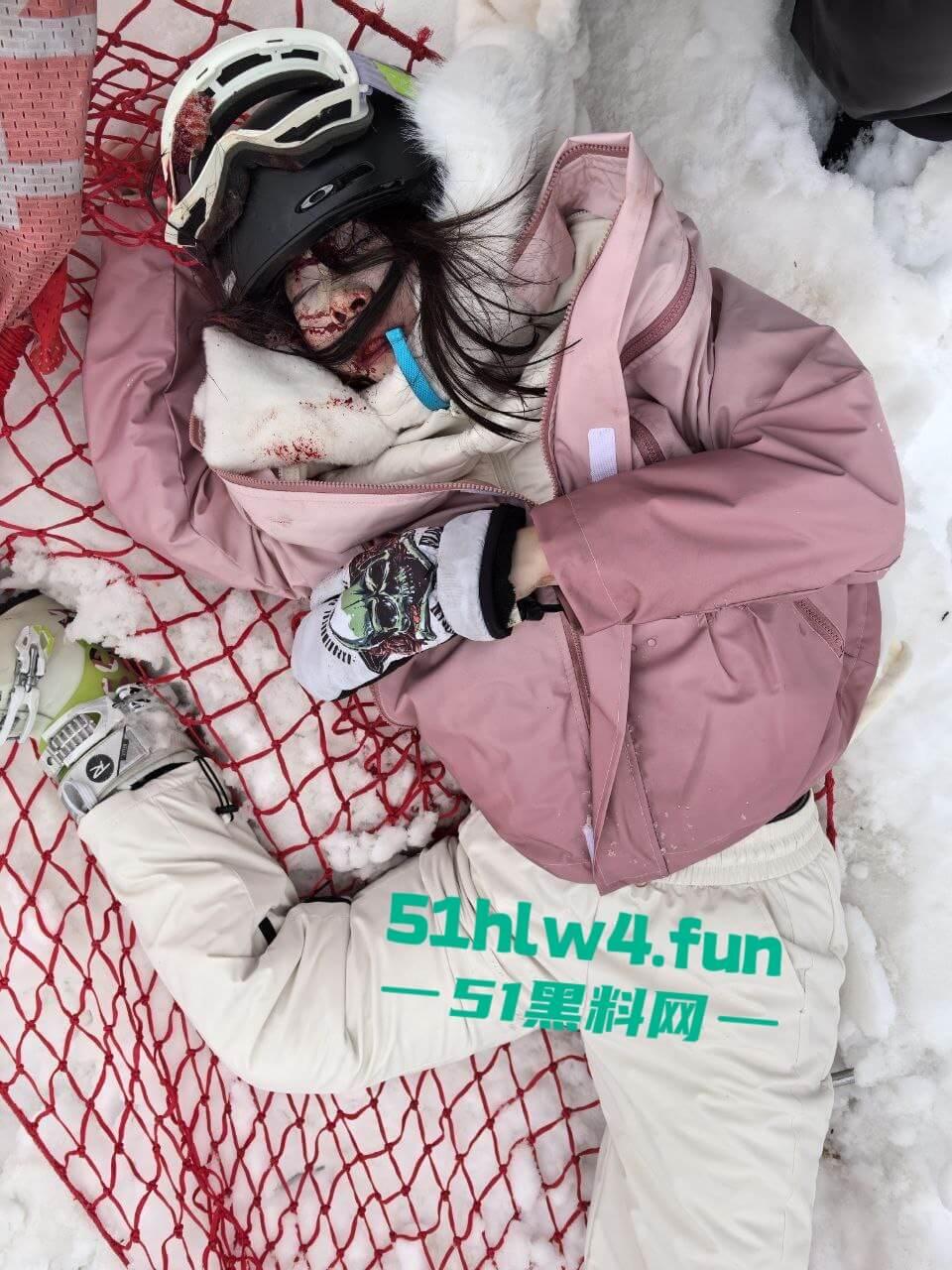 北大湖滑雪场新手滑雪妹,误入中高级滑道滑雪,不慎摔飞被撞到变形断腿场面超吓人。-9