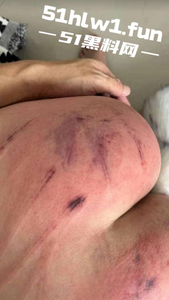 山东滨州博兴三中学生妹【于翰然】SM现场视频为了追求极致体验屁股都被大叔给打烂流血了-5