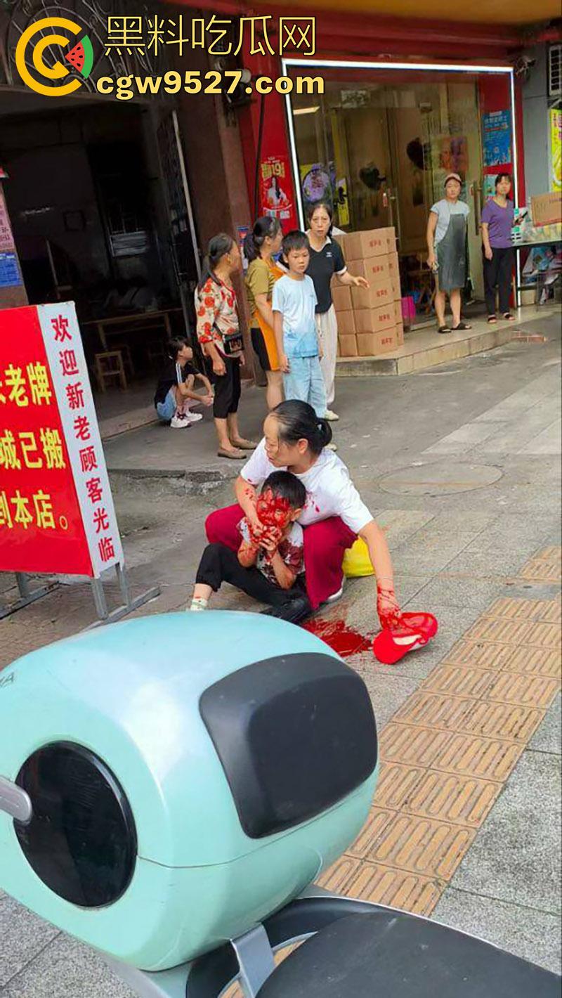 广西容县新北街电信大楼,疑似精神病中年妇女,拿铁锤砸一名小男孩,现场血腥恐怖!-2