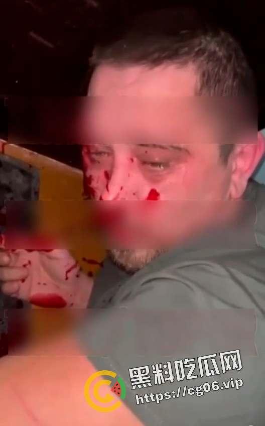 俄罗斯男子猥亵邻居女孩被监控拍下 第二天就被正义人士抓住打死-6