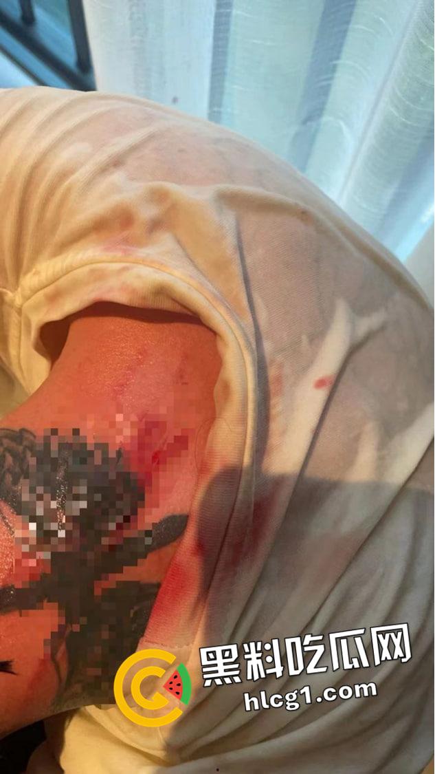 全网丢人的精神小伙【陈浩轩】背着女友偷吃被抓!被女友打的头破血流 现场视频流出-6