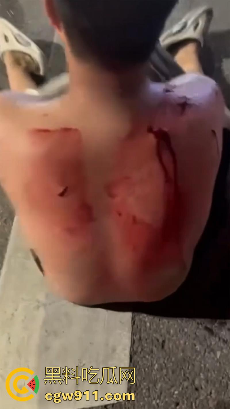 江西赣州第七中学,精神小伙小妹发生口角,叫人斗殴持砍刀砍人,警方和120急救人员陆续赶到,现场多人受伤。-5