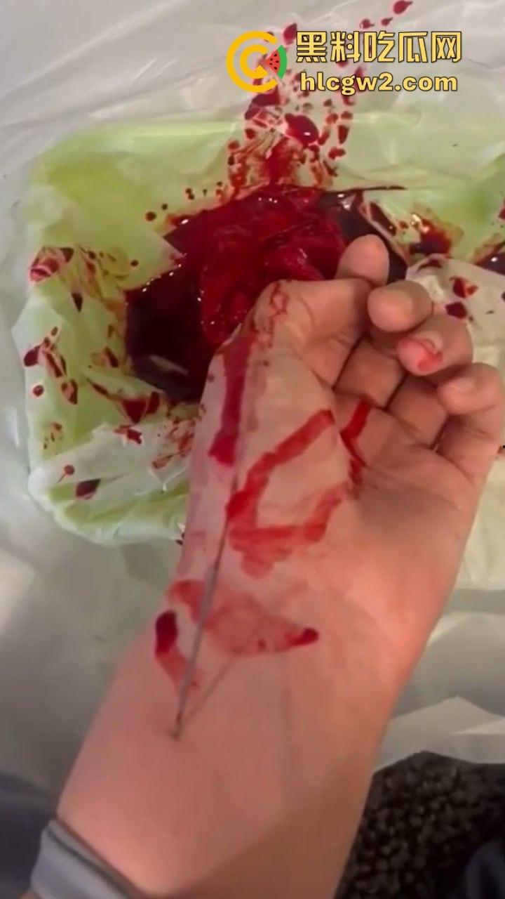 血腥慎入!推特十级脑残血腥自残自拍 残暴割腕引血自流 这是作死还是变态?-1