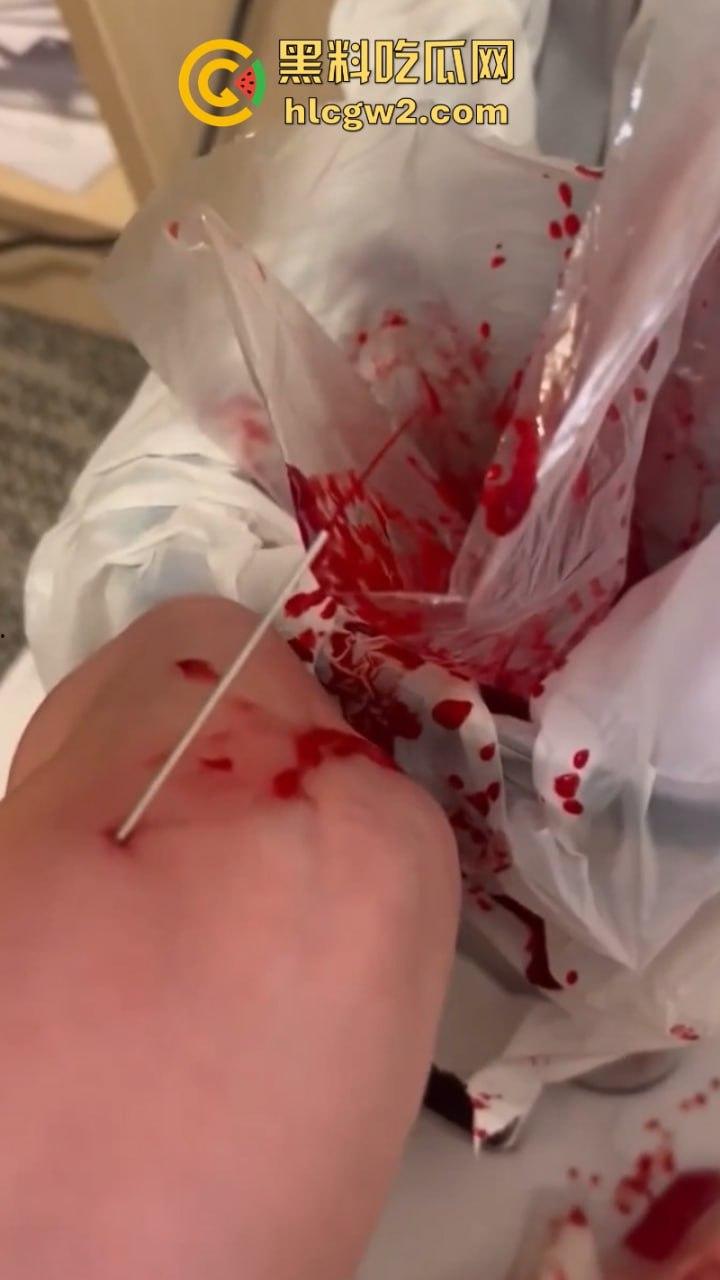 血腥慎入!推特十级脑残血腥自残自拍 残暴割腕引血自流 这是作死还是变态?-2