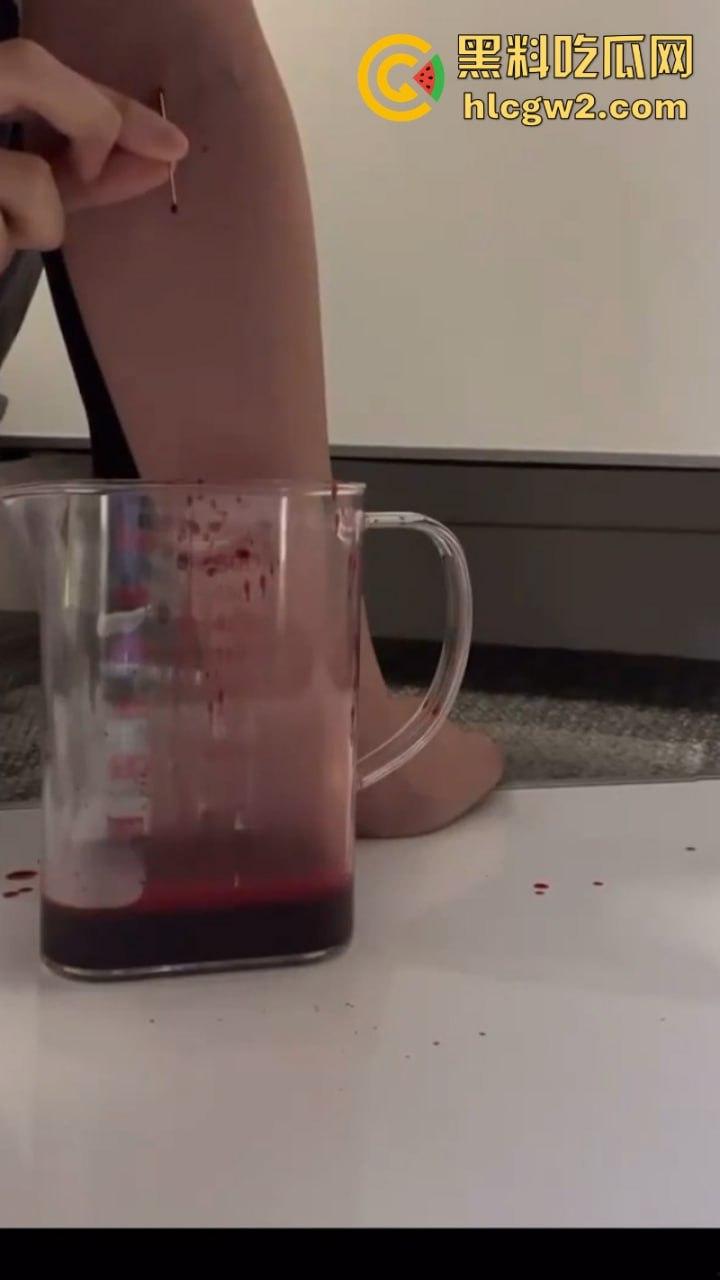 血腥慎入!推特十级脑残血腥自残自拍 残暴割腕引血自流 这是作死还是变态?-3