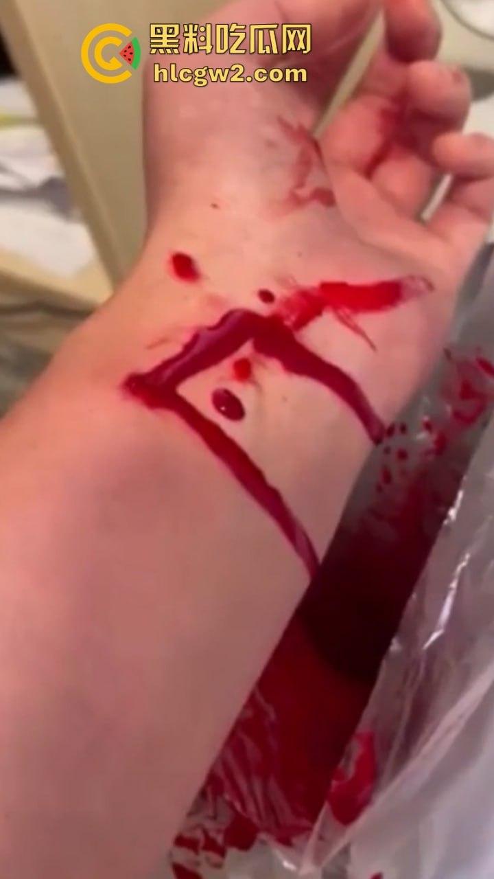血腥慎入!推特十级脑残血腥自残自拍 残暴割腕引血自流 这是作死还是变态?-5