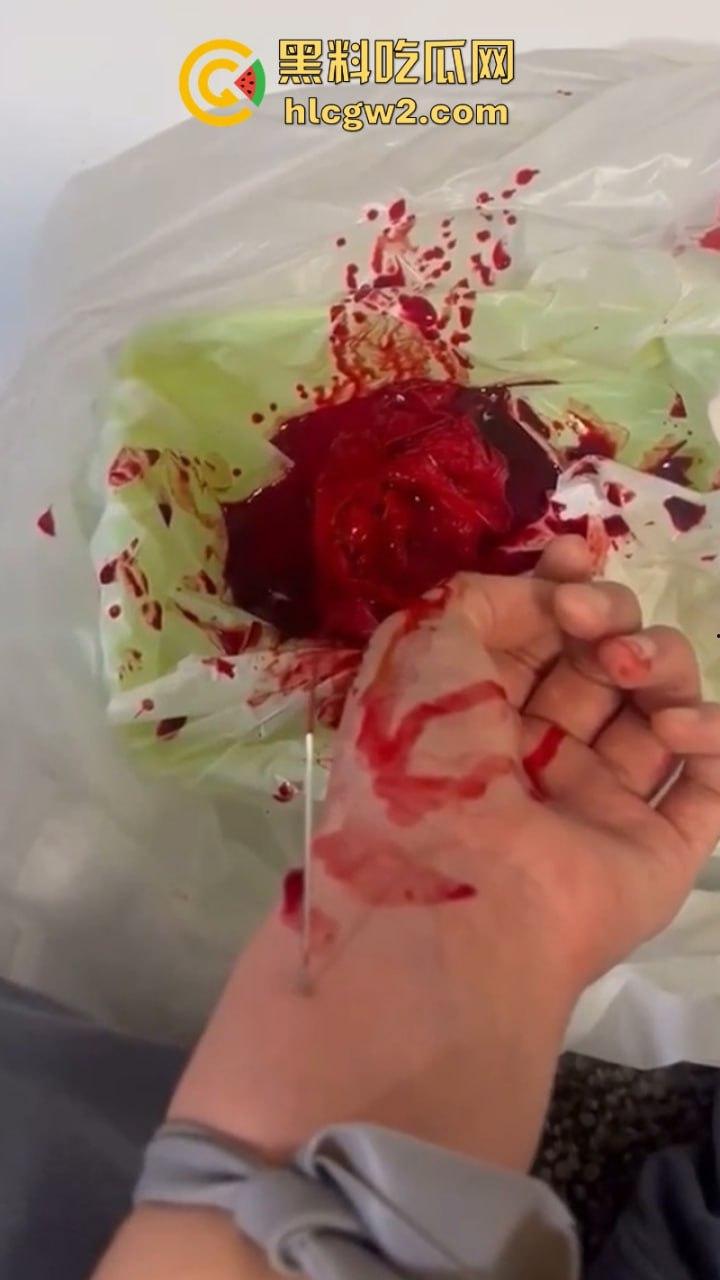 血腥慎入!推特十级脑残血腥自残自拍 残暴割腕引血自流 这是作死还是变态?-6