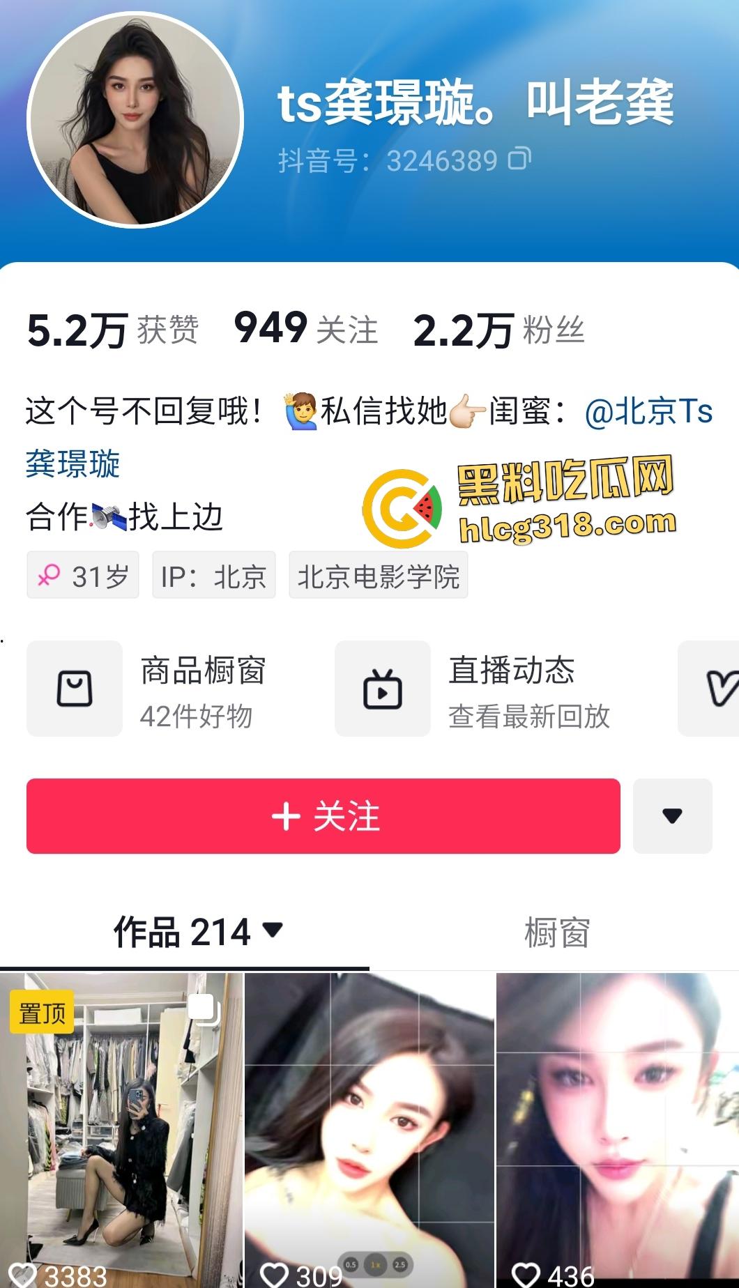 抖音【龚璟璇】人妖绿茶婊翻车！黑丝口交被秃顶金主内射，鸡鸡对鸡鸡比人体蜈蚣还骚！-1