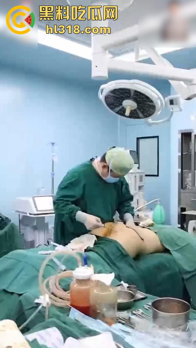 实拍整形医院手术现场，小仙女为了变美，抽脂和填充全过程，虽然看着残忍，但做完后的确是好看呢！-8