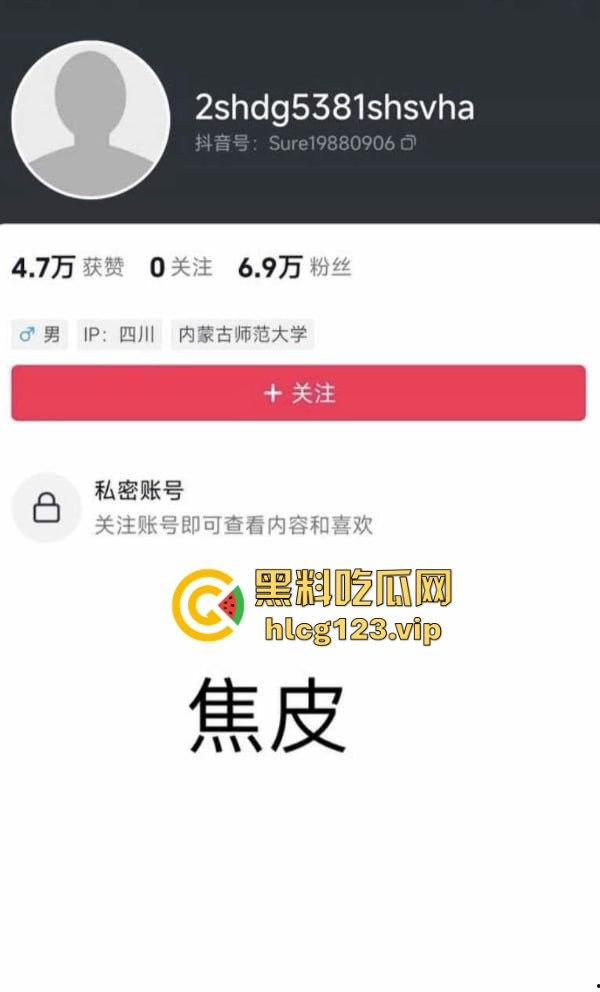 软饭小王子『焦皮』！抱富婆、撩老头，变性网红『智博』钱袋被掏空，软饭吃到爽！-2