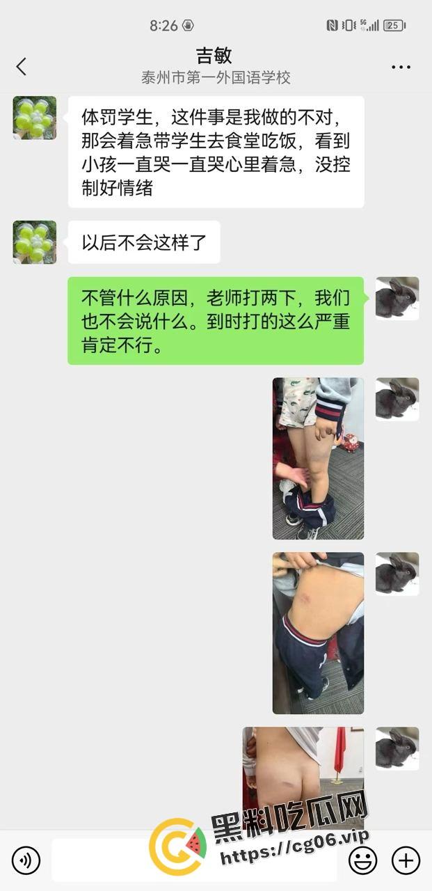 泰州外国语小学老师暴打小学生 全身淤青 家长群内声讨被解散 至今无说法-1