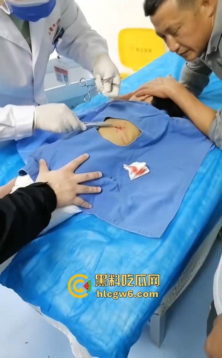 江西赣州母女在公园散步被四条野狗攻击撕咬，扯下来的肉被吃掉，暴露性伤口可以塞进一只手-10