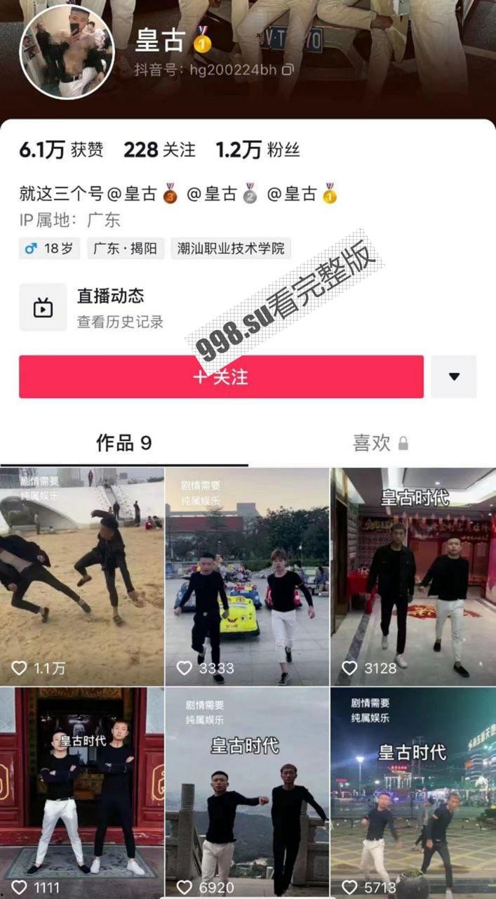 抖音 精神小伙 皇古 直播装逼失败裤裆着火 希望老二还能保住-1