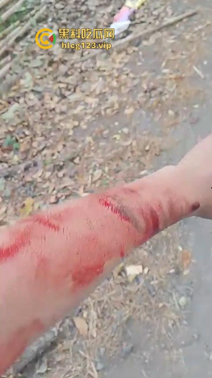 大型皮开肉绽现场!印尼一地发生冲突 有内战的国家真的不要去!-6