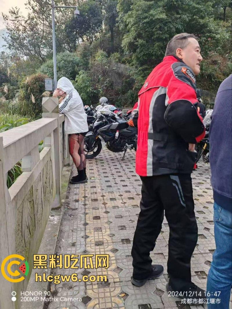 美图秀秀弱爆了 这才是真实磨皮！胖妹装逼压弯失控撞车  黑丝当场爆裂惨遭磨皮 大腿血肉模糊 真是悲惨又丢人！-6