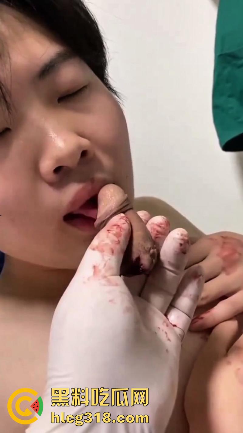 广西猛男刀切小鸡鸡，00后小火竟自己动手割下鸡巴，还给女友口交玩弄，现在都玩这么变态了么！-5