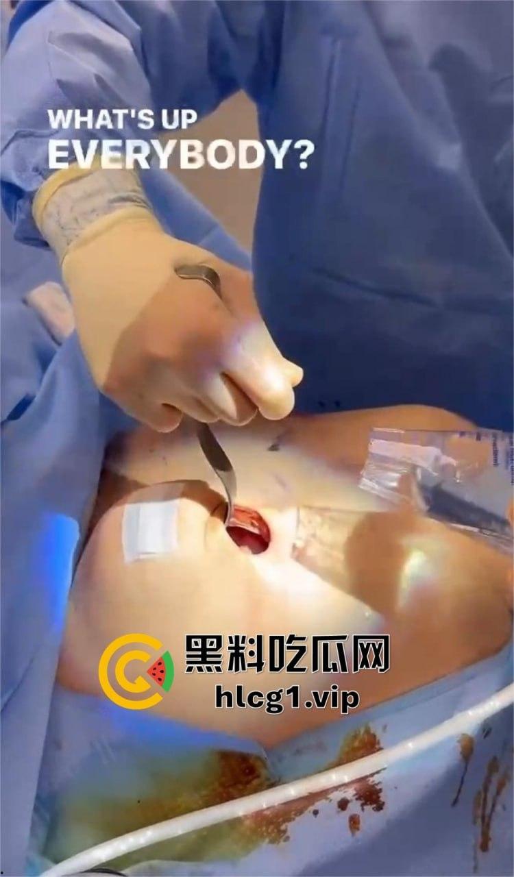 7W就能让你机场变巨乳!抖音上那些36D大胸妹子,原来都是这么来的!-6