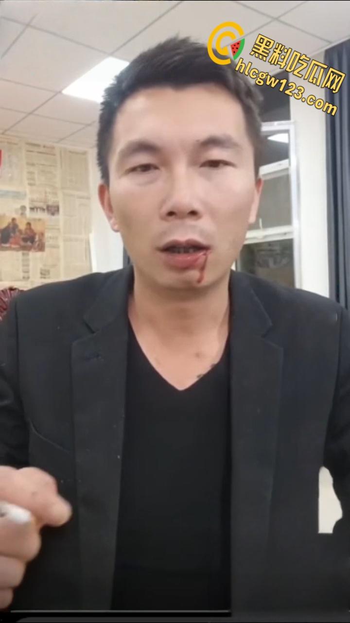 抖音狠人博流量 , 鞭炮嘴炸出血,脑残操作震惊全网 !-6