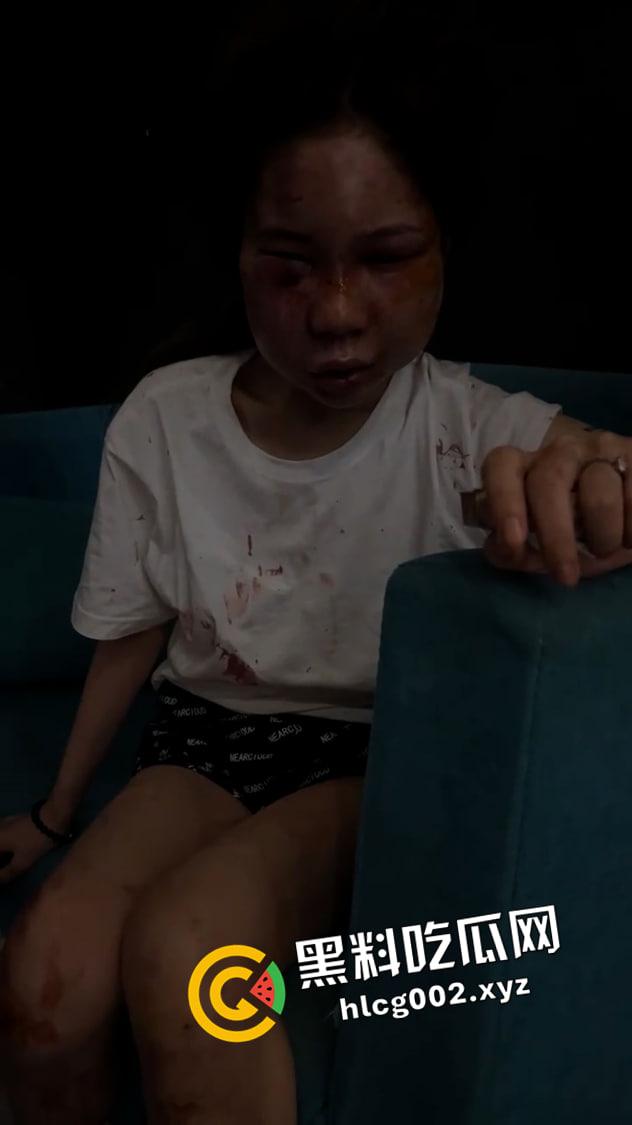 【谭竹】终被制裁打成猪头！外网悬赏金额已达六百万  现场视频流出-3