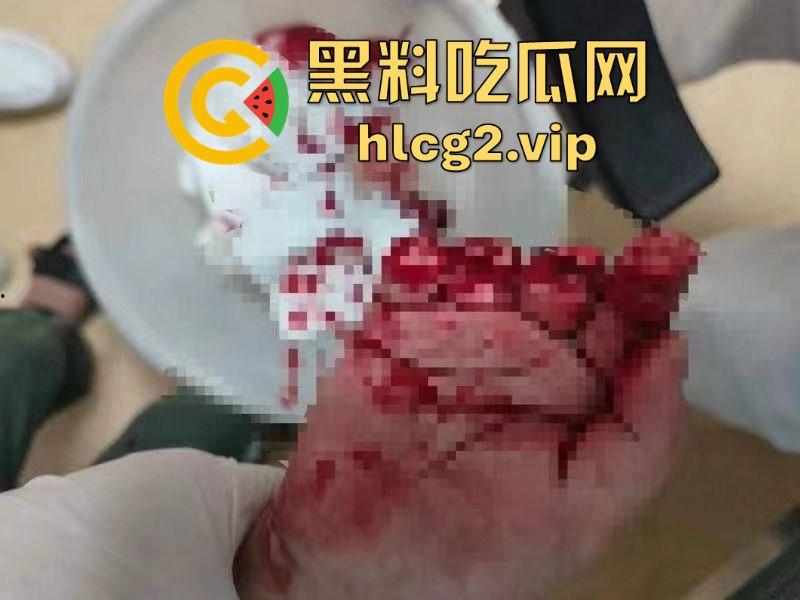 南宁熊孩子玩奶茶封口机被夹断四根手指！家长慌了才后悔疏忽奶茶店一片惊叫！-9