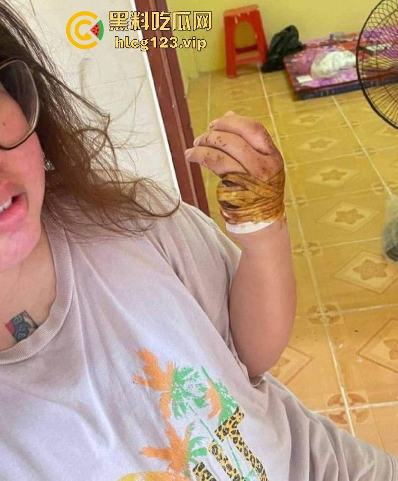 柬埔寨骗招诱国人入境 再要求家里500万赎人 剁手殴打暴力索钱视频流出 胆小慎入-1