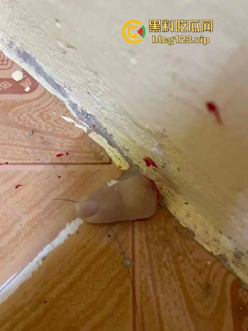 柬埔寨骗招诱国人入境 再要求家里500万赎人 剁手殴打暴力索钱视频流出 胆小慎入-9