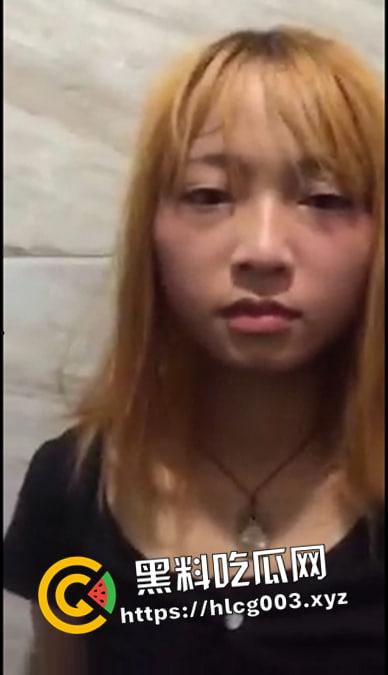 精神小妹酸奶倒进逼里  不自慰就被打 脸和逼都被打肿了 现场视频流出-1