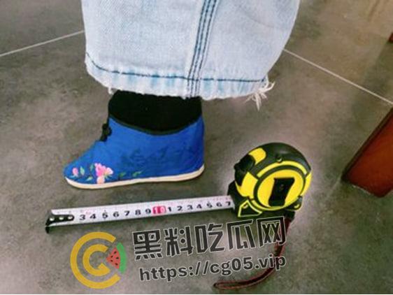 新时代裹脚女性!00后女生爱上裹脚 推特分享裹脚经历 把脚缠到骨折变形 吓人!-4
