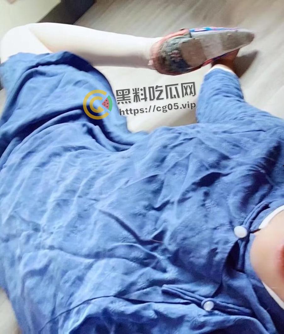 新时代裹脚女性!00后女生爱上裹脚 推特分享裹脚经历 把脚缠到骨折变形 吓人!-16