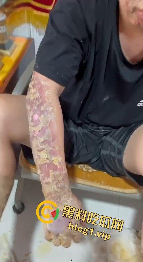 内蒙古呼和浩特惊魂一刻!02年精神小伙偷骑V4机车撞上右转SUV,摩托车当场燃烧!-9