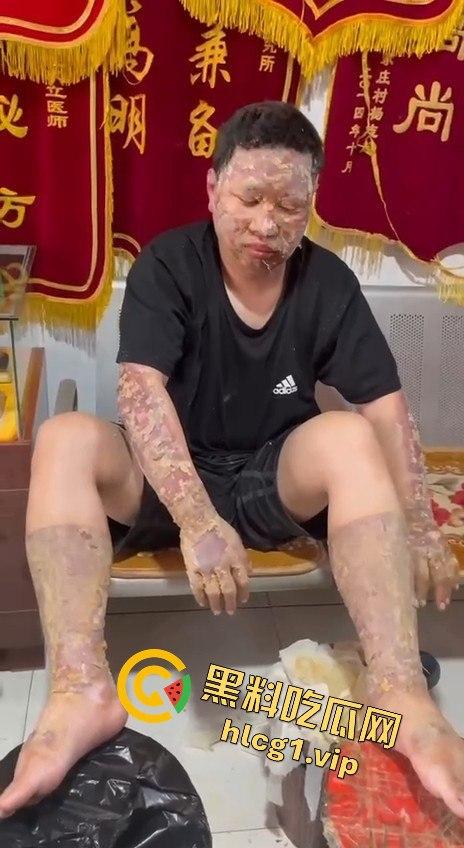 内蒙古呼和浩特惊魂一刻!02年精神小伙偷骑V4机车撞上右转SUV,摩托车当场燃烧!-12