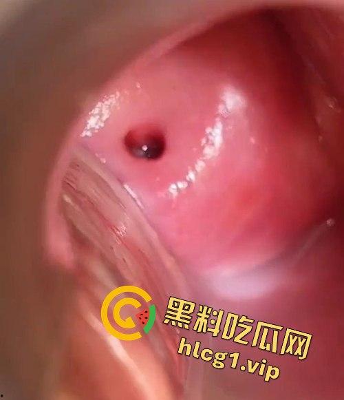 医生偷拍年轻嫩妹王雪检查全程！双腿大开取白带，清纯妹子惨遭曝光！-8