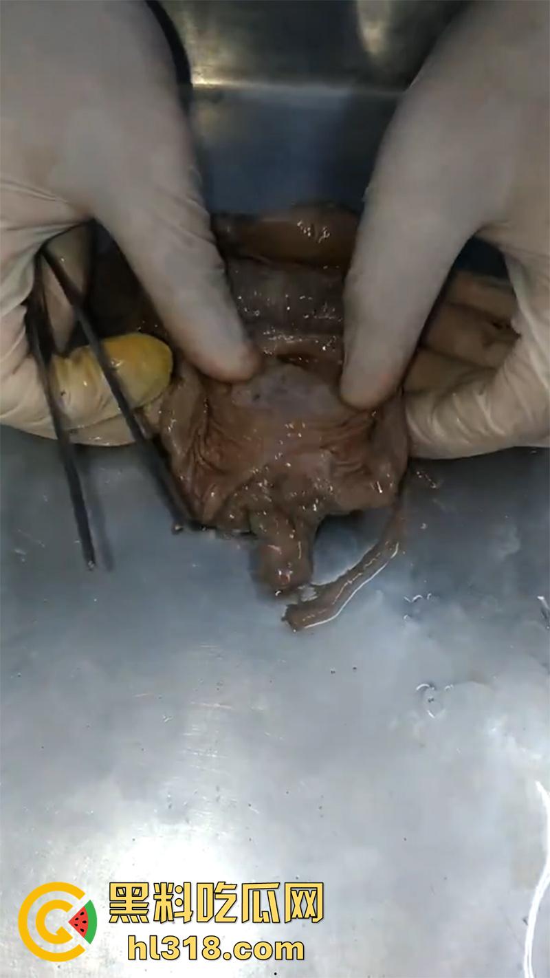 真实西藏密宗法器“肉莲花”，少女被108罗汉轮奸后，五毒侵蚀九蒸九炼，活体切割才可肉莲大成！-3