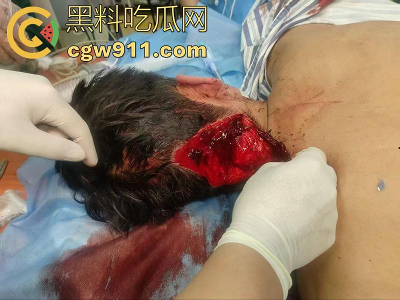 退伍兵都憋坏了吧，酒吧遇到认识的美女，直接上手撩骚，其表哥上前理论被群殴，提刀一穿四，这兵真是白当了！-2