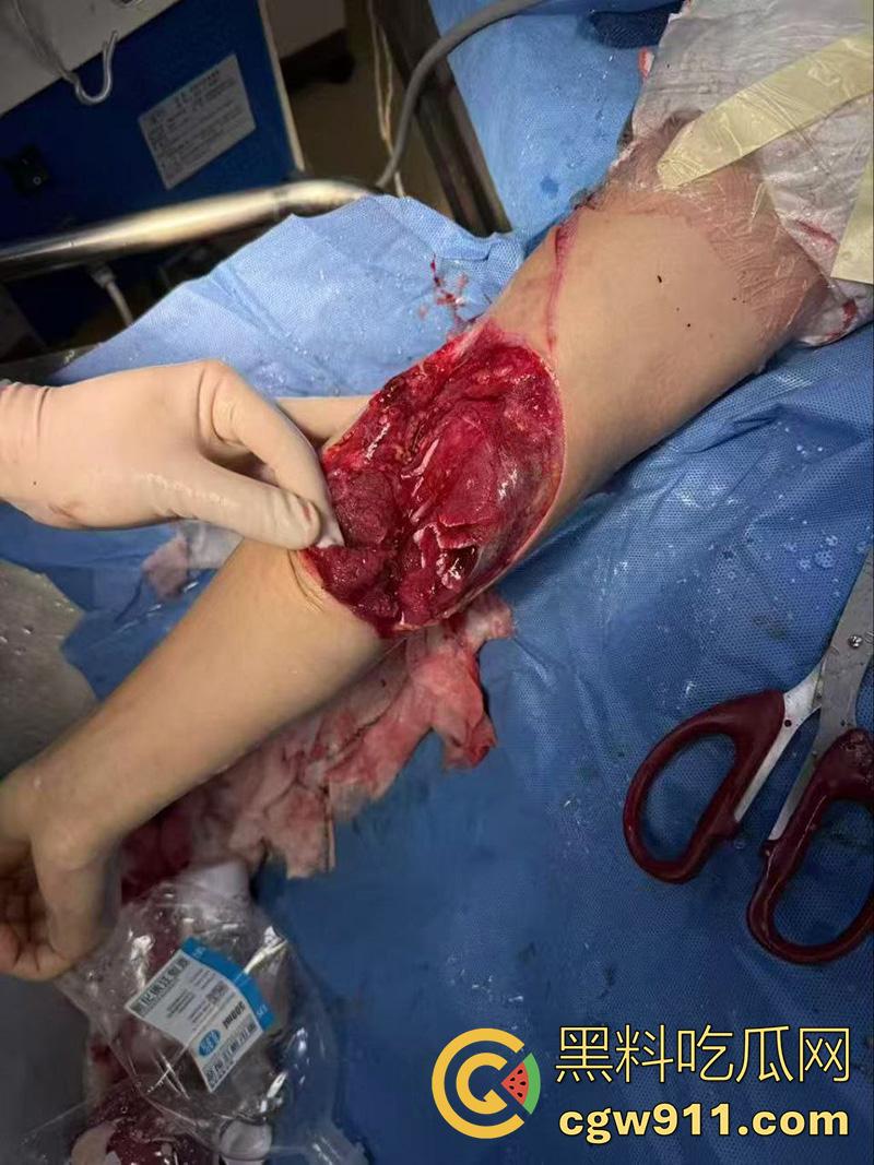 退伍兵都憋坏了吧，酒吧遇到认识的美女，直接上手撩骚，其表哥上前理论被群殴，提刀一穿四，这兵真是白当了！-3