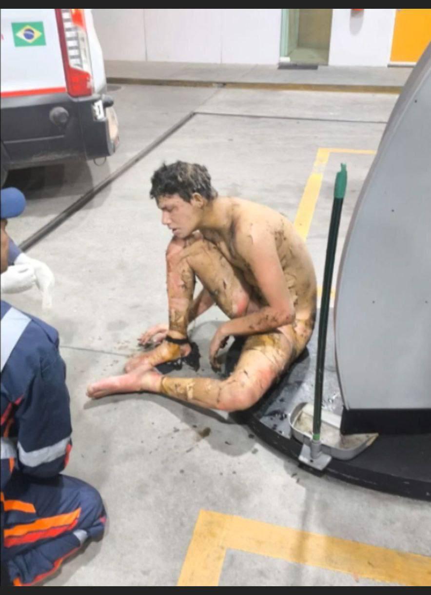 巴西心碎男分手后伤心欲绝，汽油自焚，监控曝光现场惨烈，大火吞噬全身，血肉模糊令人不忍直视-9