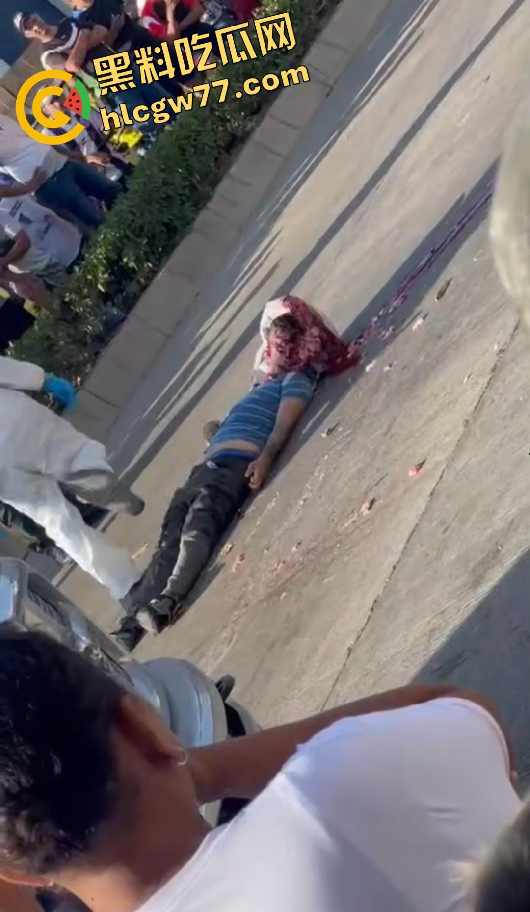 蓝色衣服男电动车车祸爆头血腥惨剧!眼珠弹出还能救?世上竟有神人?-1