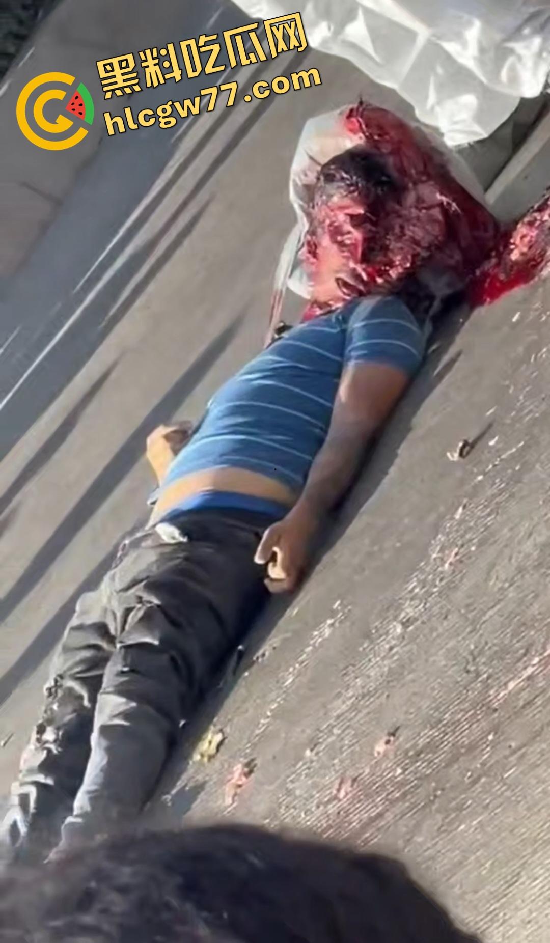 蓝色衣服男电动车车祸爆头血腥惨剧!眼珠弹出还能救?世上竟有神人?-4