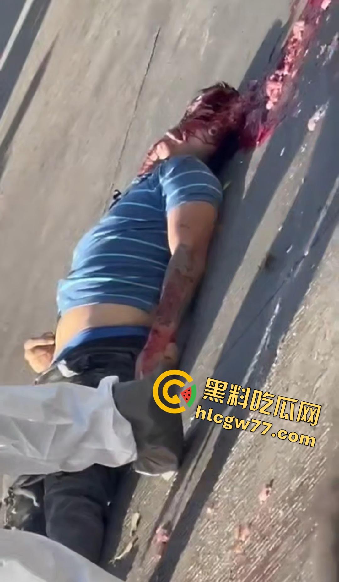 蓝色衣服男电动车车祸爆头血腥惨剧!眼珠弹出还能救?世上竟有神人?-5