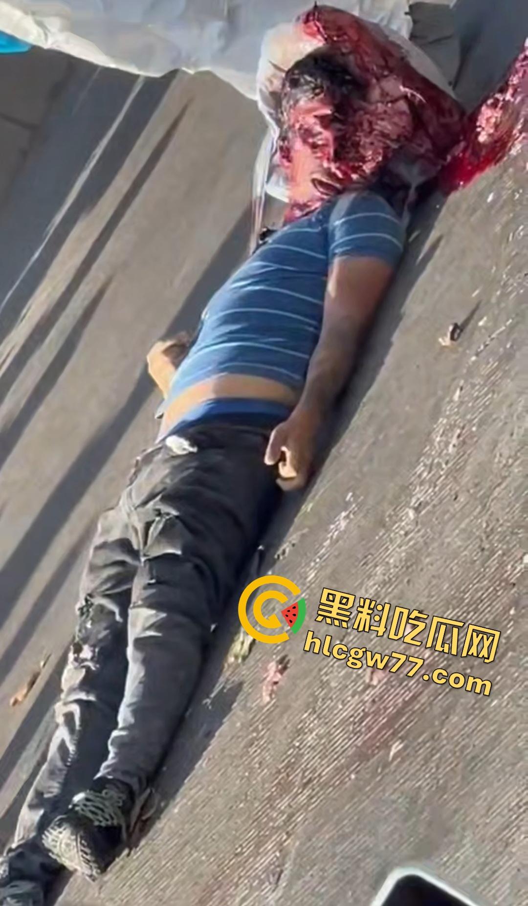 蓝色衣服男电动车车祸爆头血腥惨剧!眼珠弹出还能救?世上竟有神人?-7