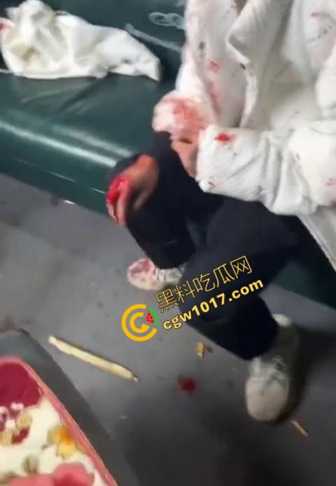 血腥慎点！社会混混残忍虐打小伙，马桶刷戳脸，铁管刺手，手背戳破血肉模糊，骨头暴露，惨不忍睹，令人心寒！-8