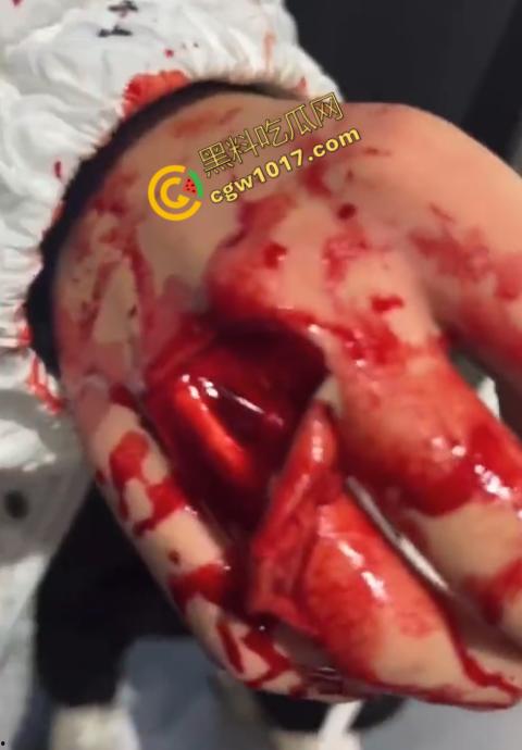 血腥慎点！社会混混残忍虐打小伙，马桶刷戳脸，铁管刺手，手背戳破血肉模糊，骨头暴露，惨不忍睹，令人心寒！-10