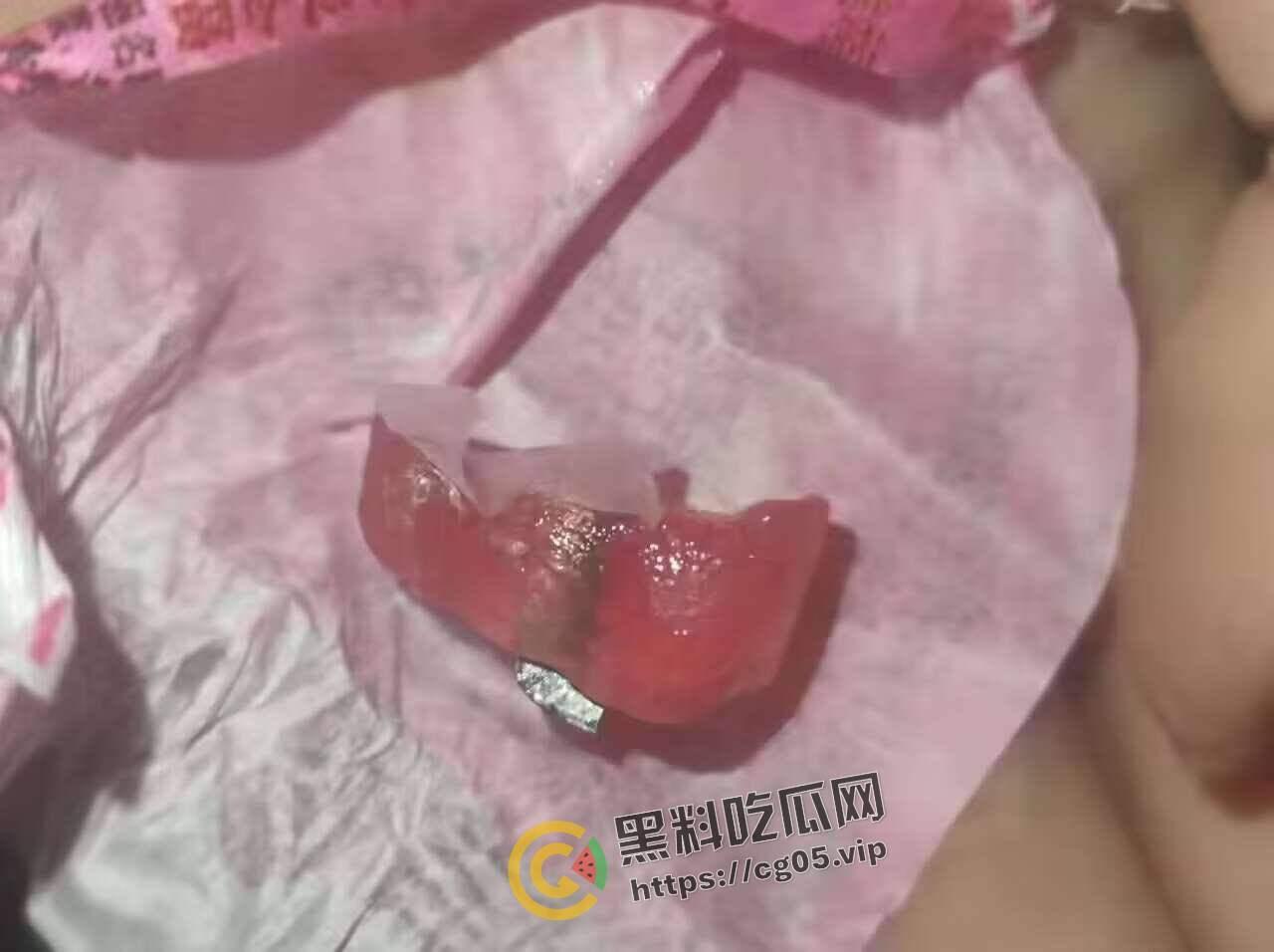 济南幻樱漫展投毒事件！多人在漫展收到免费赠送的零食中发现刀片 药丸等异物 附上相关报道以及漫展骚货视频-7