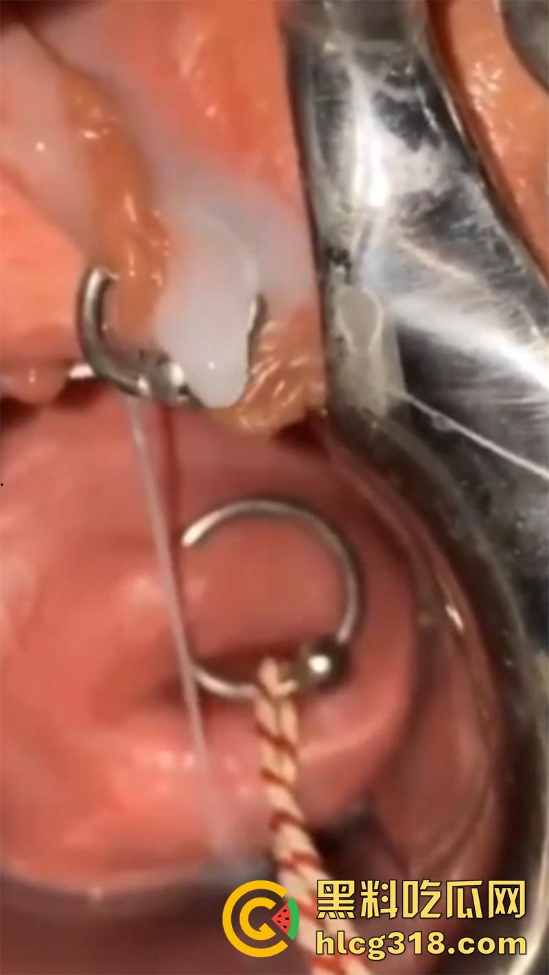 重口极限引导扩张虐穴,逼里塞图钉钢管插子宫口,鸡巴爆插尿道操的骚逼白浆四溢,宫颈真像个鱼唇!-7