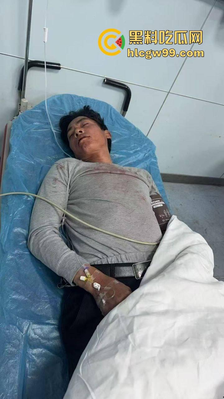 广东汕头潮阳西胪市场因生意太曝火而遭同行报复，现当事人已进医院，现场惨烈曝光！-1