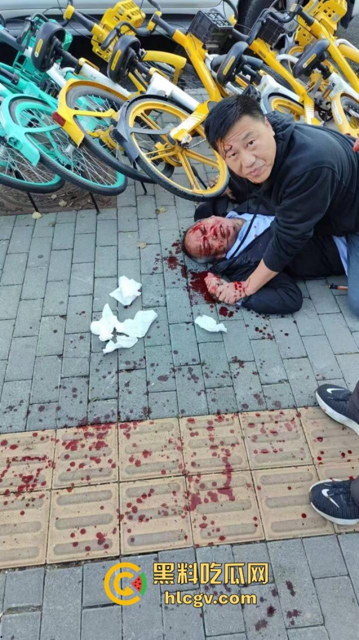 没人性！北京海淀区男子当街砍人报复社会 专挑孩子下手 现场血腥惨烈视频曝光-11